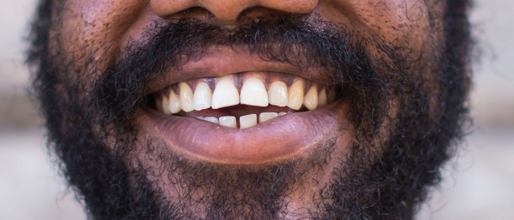 Bild på man som ler